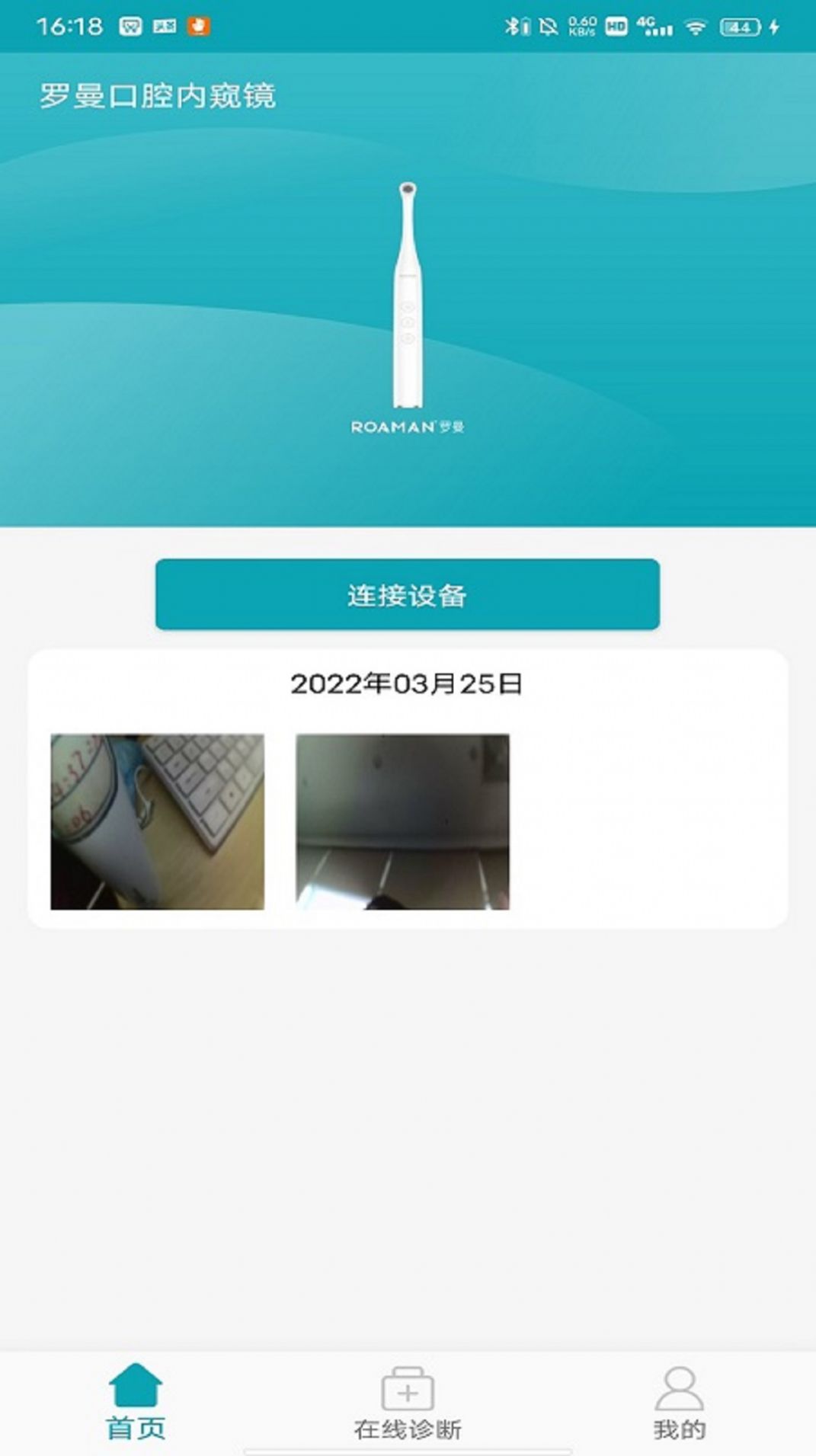 罗曼口腔内窥镜app官方版 v1.0.0