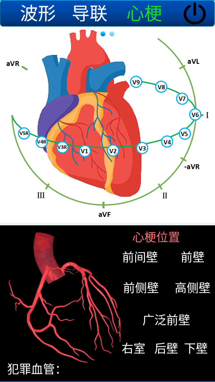 心电图计算器免费版